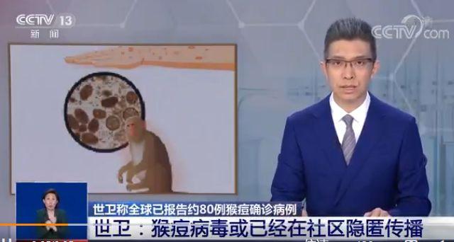 猴痘疫情最新消息/猴痘疫情最新消息国内-第3张图片 猴痘疫情最新消息/猴痘疫情最新消息国内-第3张图片