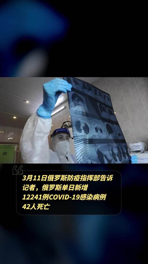 俄罗斯疫情/俄罗斯疫情严重吗-第2张图片 俄罗斯疫情/俄罗斯疫情严重吗-第2张图片