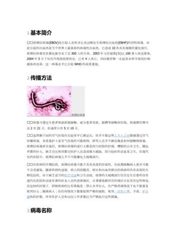 2014埃博拉疫情/1976埃博拉疫情-第4张图片 2014埃博拉疫情/1976埃博拉疫情-第4张图片