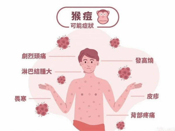 猴痘疫情(猴痘疫情最新进展)-第4张图片 猴痘疫情(猴痘疫情最新进展)-第4张图片