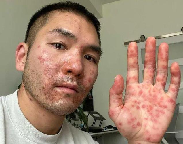 美媒质疑美疫情数据,美国质疑新冠报告-第6张图片 美媒质疑美疫情数据,美国质疑新冠报告-第6张图片