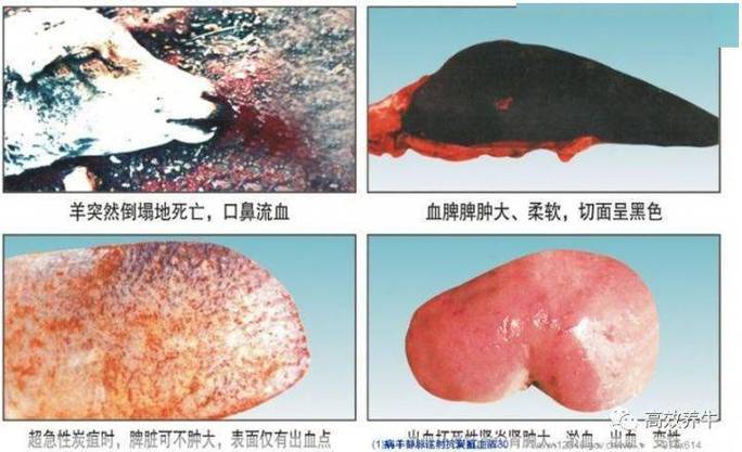 鞍山炭疽疫情(鞍山疑似)-第3张图片 鞍山炭疽疫情(鞍山疑似)-第3张图片