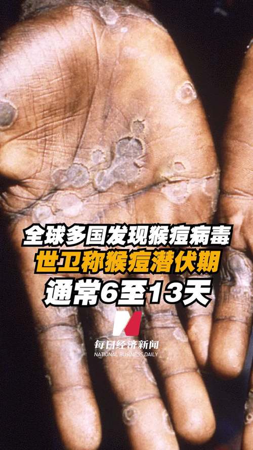 江苏疫情(江苏疫情最新消息2024年)-第6张图片 江苏疫情(江苏疫情最新消息2024年)-第6张图片