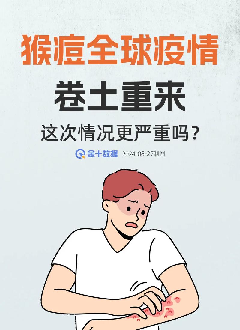 巴西斯疫情(巴西斯疫情最新情况)-第1张图片 巴西斯疫情(巴西斯疫情最新情况)-第1张图片