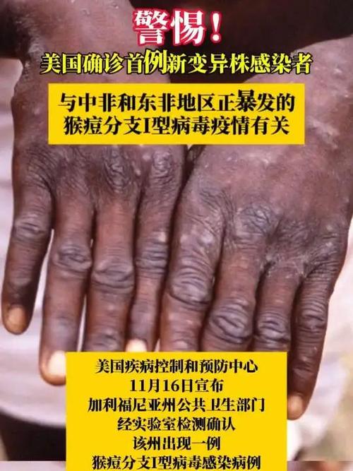 【巴尔的摩疫情,巴尔的摩枪击案 新闻】-第5张图片 【巴尔的摩疫情,巴尔的摩枪击案 新闻】-第5张图片