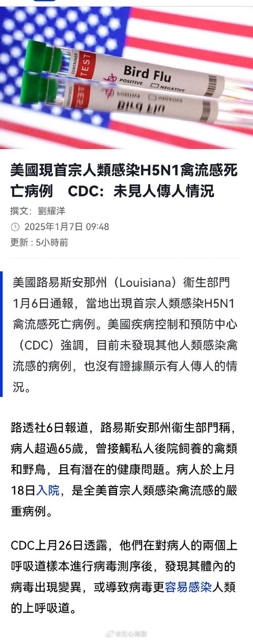 2008年美国疫情-美国1981年疫情