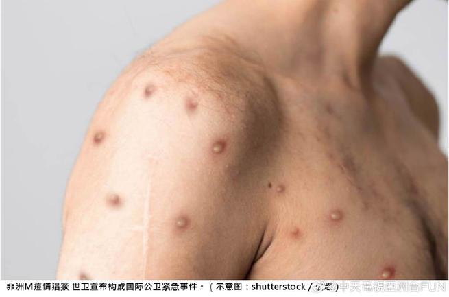 疫情污名化,疫情污名化中国的言论作文-第2张图片 疫情污名化,疫情污名化中国的言论作文-第2张图片