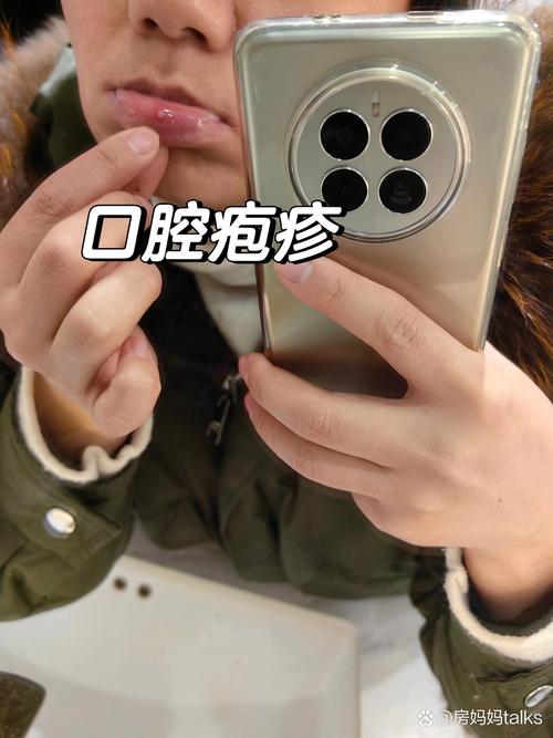 巴西疫情发展时间,巴西疫情现状如何-第2张图片 巴西疫情发展时间,巴西疫情现状如何-第2张图片