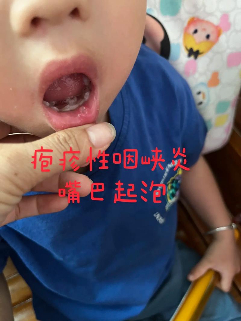 巴西疫情发展时间,巴西疫情现状如何-第4张图片 巴西疫情发展时间,巴西疫情现状如何-第4张图片