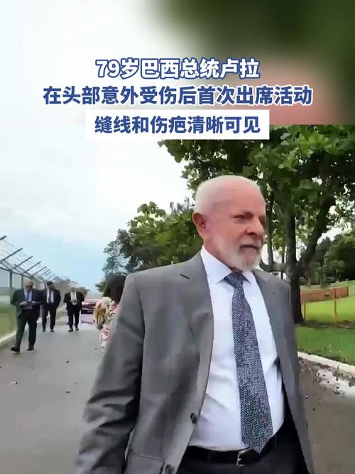 巴西疫情防疫(巴西疫情疫情)-第2张图片 巴西疫情防疫(巴西疫情疫情)-第2张图片