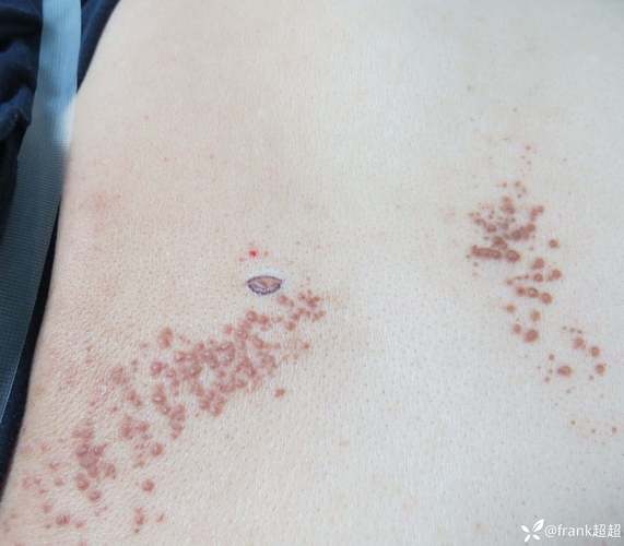 安丘吧疫情-安丘最新-第2张图片 安丘吧疫情-安丘最新-第2张图片