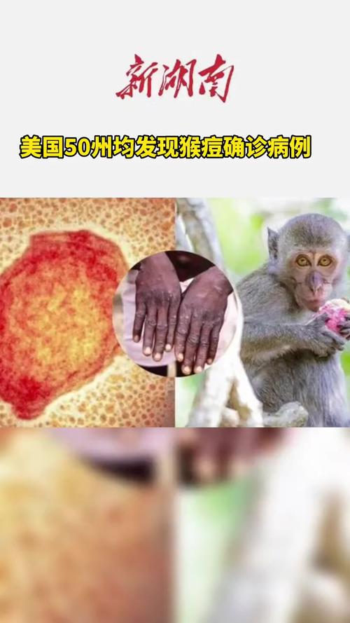 美媒质疑美疫情数据(美媒报道美国疫情)-第4张图片 美媒质疑美疫情数据(美媒报道美国疫情)-第4张图片