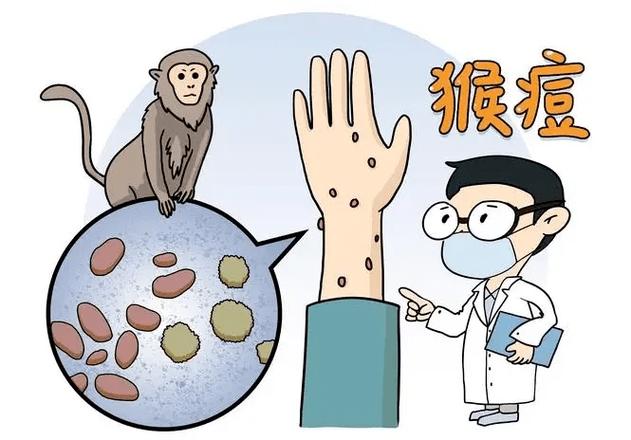 猴痘疫情(猴痘疫情全球最新消息)