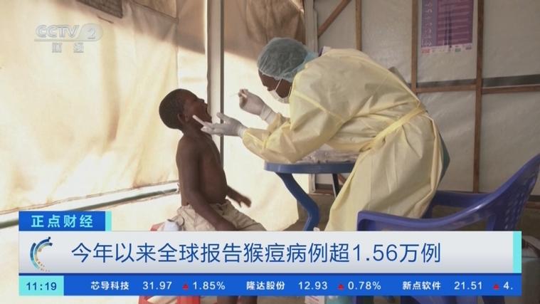 猴痘疫情最新消息-猴痘疫情最新消息2025年-第5张图片